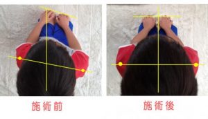 あひる座り（ぺったんこ座り）　男の子も注意