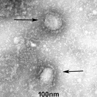 新型コロナウィルス