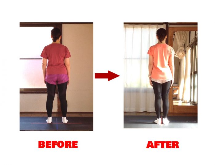 Mさんビフォーアフター１