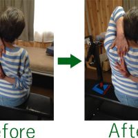 よくばり症例Oさん