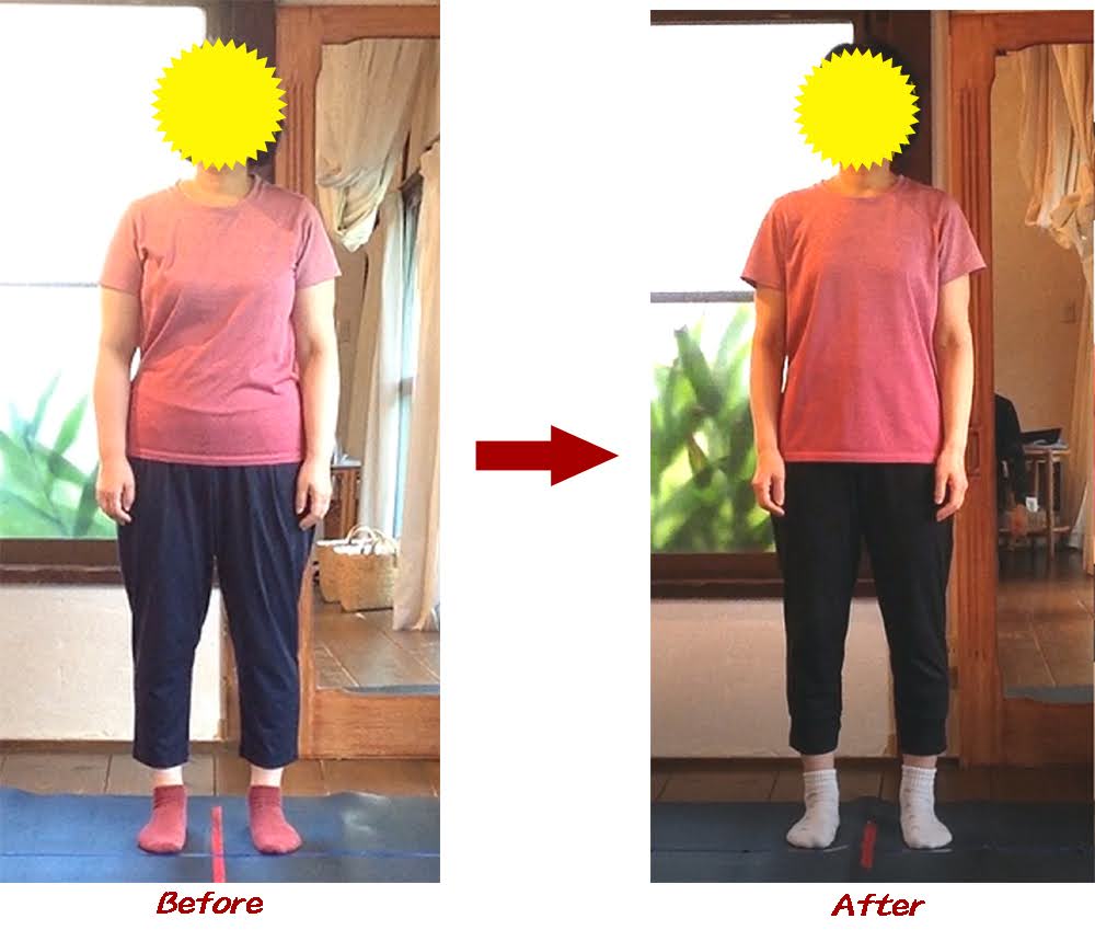 Kさんビフォーアフター3