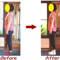 Kさんビフォーアフター6